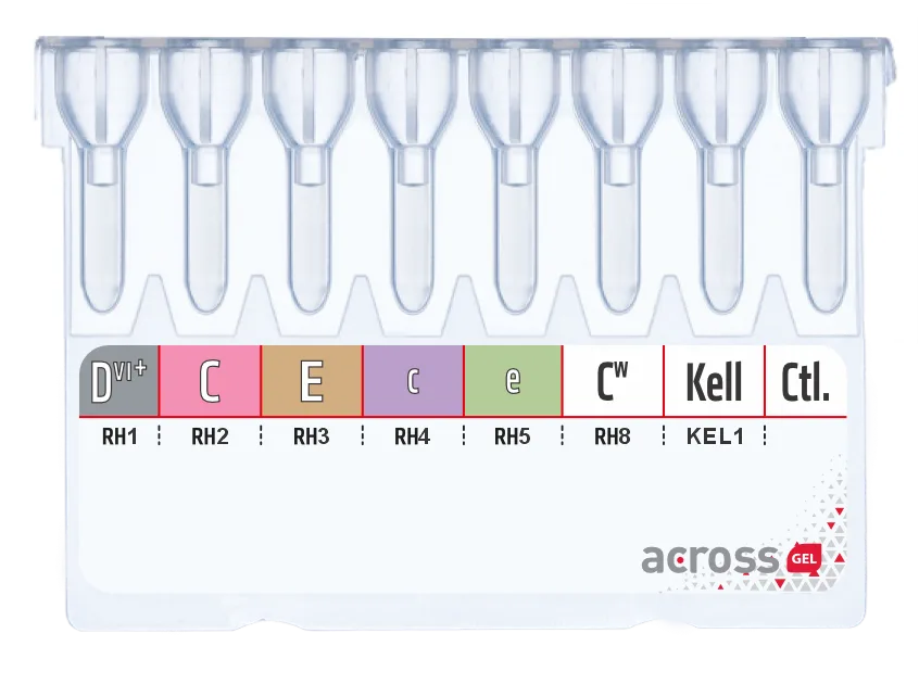Rh Phenotyping with Kell (K)